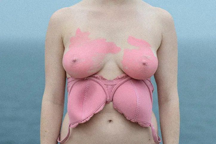 Prue Stent