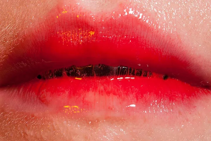 Jonas Lindstroem