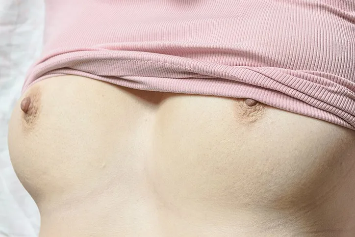 Prue Stent