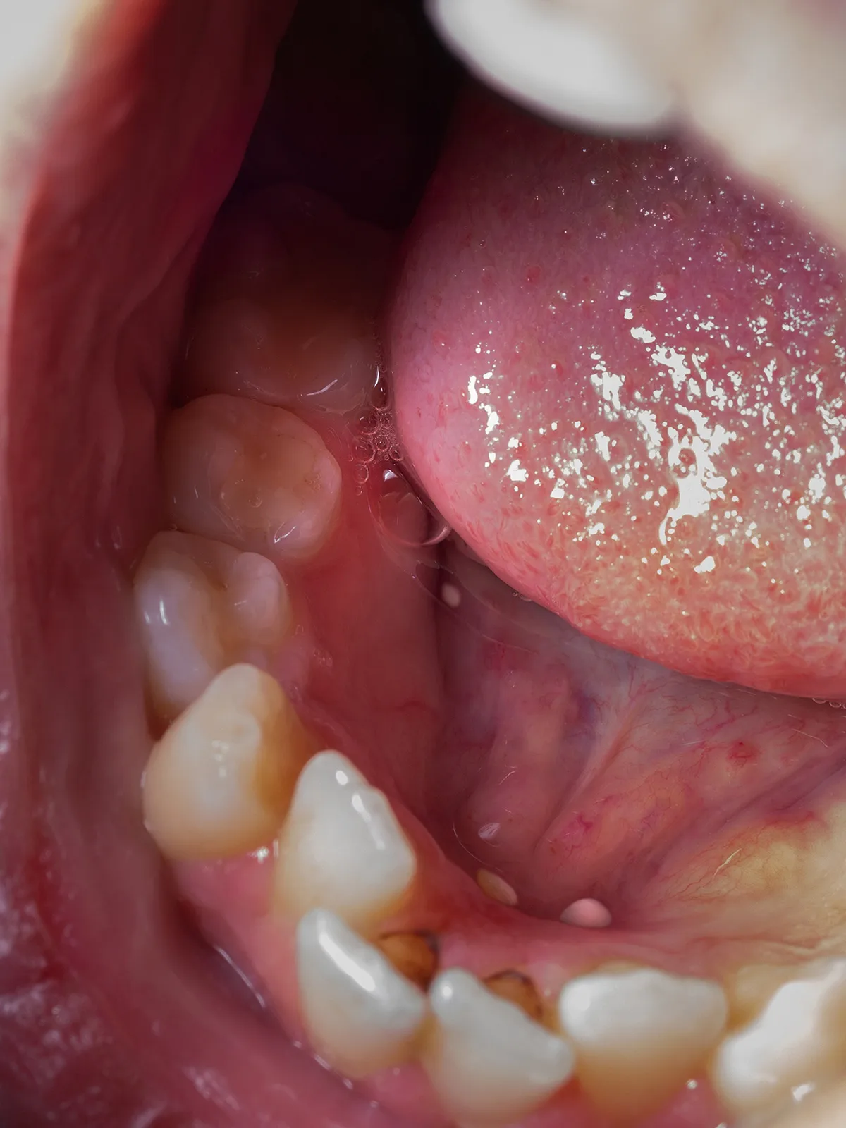 Nika-Sandler_A-History-of-Teeth_04