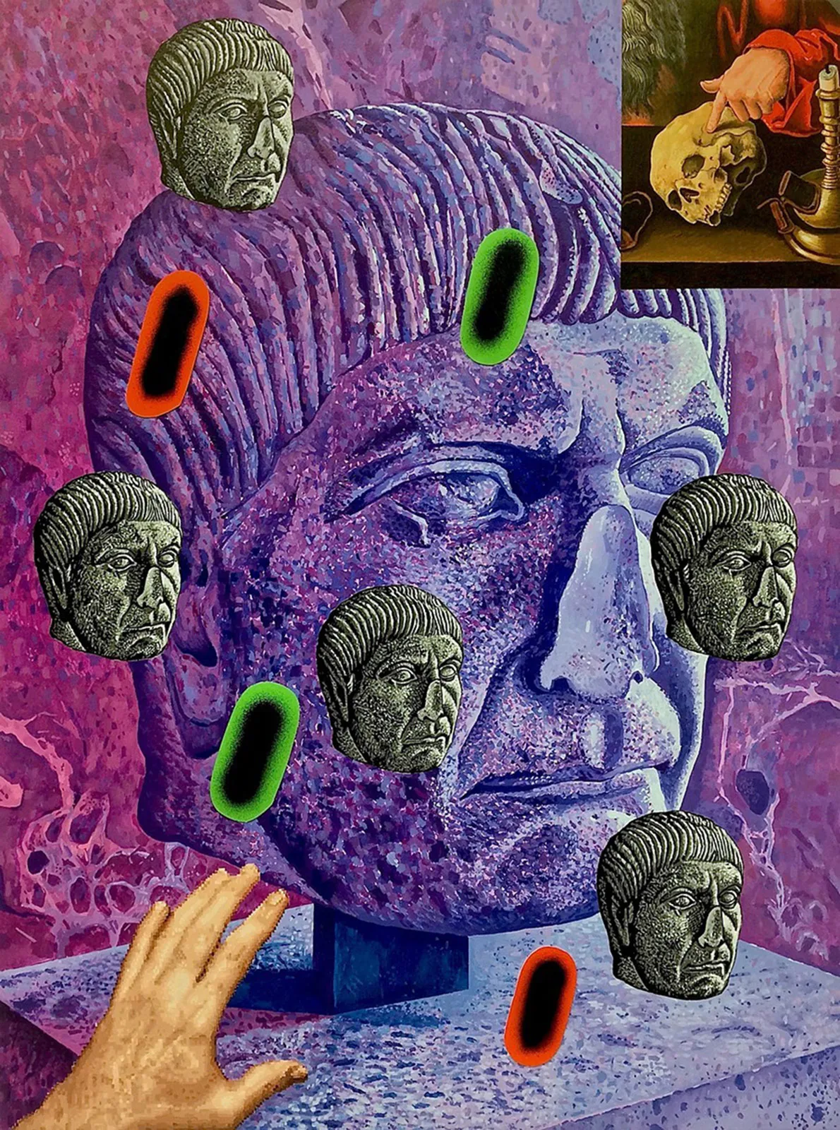 No Nose